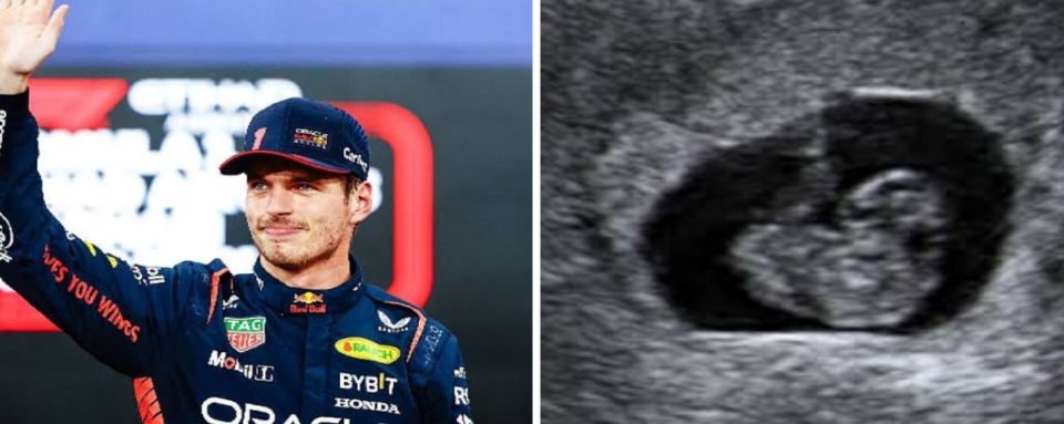 GOOD NEWS: 🎊 Max Verstappen  Announces 8-weeks pregnancy of Twin babies with her Lover……